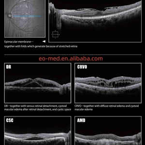 Équipement d'optique ophtalmologique au prix le plus bas, machine de tomographie par cohérence optique OCT, OCT20 - Product Image 6