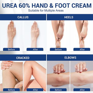 Venta Directa de Fábrica, <span class=keywords><strong>Crema</strong></span> Hidratante <span class=keywords><strong>para</strong></span> Pies de 80 ml, Blanqueadora, Nutritiva, Reparadora de Grietas en los Pies - Product Image 4