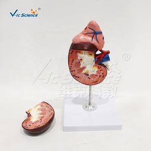 Modelo de Estructura Renal Humana con Glándula Adrenal, Espécimen de PVC para Entrenamiento en Laboratorio de Anatomía, <span class=keywords><strong>Nefrología</strong></span> <span class=keywords><strong>y</strong></span> <span class=keywords><strong>Urología</strong></span>, CE/ISO/ROHS/CNAS - Product Image 3