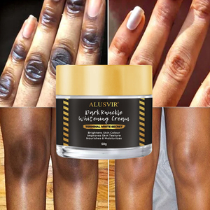 Crema Schiarente per Corpo con Etichetta Privata, Lozione Corpo Sbiancante Forte per Nocche e Ginocchia Scure, Idratante e Illuminante - Product Image 1