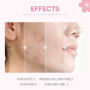 ชุดผลิตภัณฑ์บำรุงผิวหน้า LAIKOU Sakura Private Label ต่อต้านริ้วรอย ช่วยให้ผิวกระจ่างใสและชุ่มชื้น ด้วยเซรั่มและครีมบำรุงผิวหน้าที่มีส่วนผสมของไนอะซินาไมด์ - Product Image 4