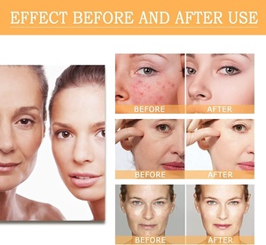 Solution Tonifiante et Resurfaçante à l'Acide Glycolique 7% pour Imperfections et Acné, Exfoliation Faciale, <span class=keywords><strong>Astringente</strong></span> Pores, Toner à l'Acide Glycolique 7% - Product Image 5