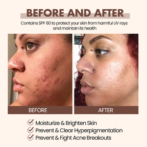 Productos para el cuidado de la piel de caramelo de etiqueta privada, suero facial antiacné que ilumina la piel negra, conjunto de cuidado de la piel con loción corporal, fabricantes - Product Image 3
