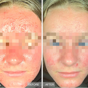 Máy Quét Da DJM Visia Máy Phân Tích 3D Face View Portable Magic Mirror Máy Dò Da Phân Tích Khuôn Mặt - Product Image 3