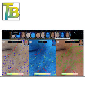 Mesin Analisa Kulit Profesional Berkualitas Tinggi 2019/ Tes Kulit/ Pemindai Analisa Kulit - Product Image 6