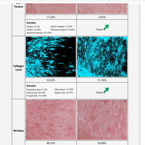 Macchina Analizzatore per Pelle e Corpo per Analisi Acne e Rilevamento Fibre di Collagene Multilingua con Logo OEM - Product Image 6