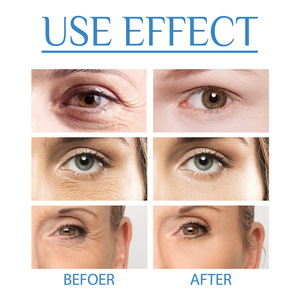 Autocollants anti-rides pour les yeux Autocollants frontaux réutilisables Patch facial Cou Poitrine Pad Peau Lifting masque pour les yeux - Product Image 4