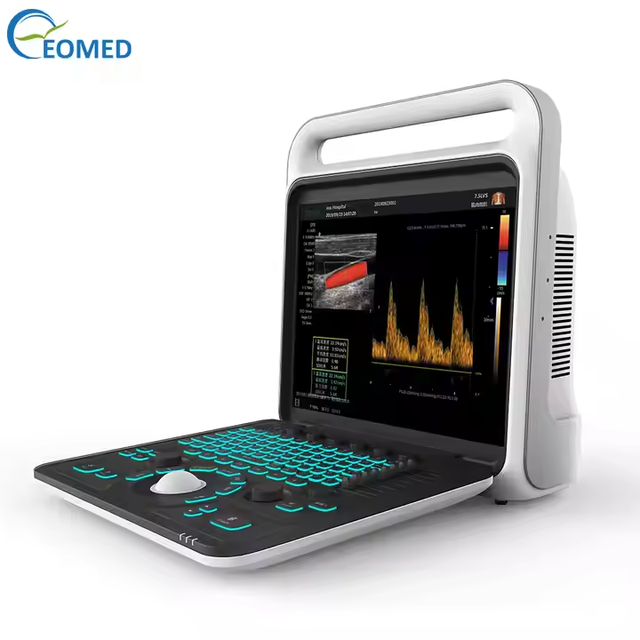 Ultrasound Machine Cardiac Diagnostic 3D 4D Color Doppler Ultrasound for Medical CU60B
