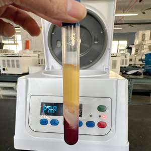 Prix de gros <span class=keywords><strong>ACD</strong></span>+GEL Tubes en plastique et en verre pour centrifugation 10ml <span class=keywords><strong>12ml</strong></span> <span class=keywords><strong>Kit</strong></span> de tubes centrifuges OEM - Product Image 2