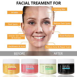 Masker Perawatan Wajah Label Pribadi Kunyit Wajah Hijau Teh Mawar Arang Wajah Merah Muda Hijau Hitam Pemutih Lumpur Tanah Liat Masker Perawatan Wajah - Product Image 6