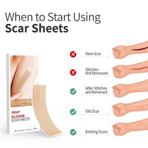 ผลิตภัณฑ์รักษารอยแผลเป็นจากสิว แผ่นแปะลดรอยแผลเป็นเกรดทางการแพทย์ แผ่นซิลิโคนลดรอยแผลเป็นแบบม้วน - Product Image 5