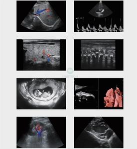 TC16 perangkat <span class=keywords><strong>ultrasound</strong></span> troli, mesin <span class=keywords><strong>ultrasound</strong></span> troli warna 4D 5D <span class=keywords><strong>3D</strong></span> <span class=keywords><strong>2D</strong></span> canggih portabel b scan - Product Image 4