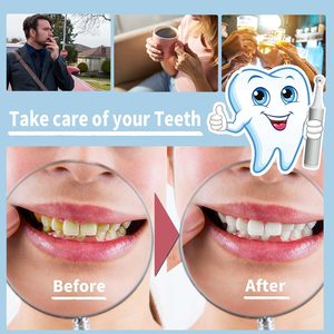 เครื่องขูดหินปูนแบบชาร์จไฟได้ - โซลูชันทำความสะอาดฟันอัจฉริยะขั้นสูง - Product Image 3