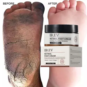 Retinol Fußpflege creme Ror Cracked Heels Peeling Anti-Riss-Peeling Entfernung abgestorbener Haut Fuß reparatur White ning Fuß creme