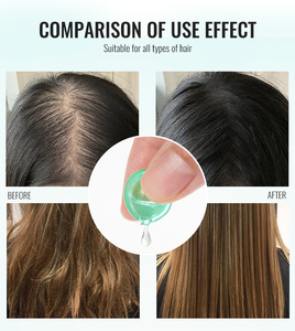 Label privé soins capillaires traitement naturel du cuir chevelu huile d'argan collagène caviar huile romarin huile de croissance des cheveux - Product Image 3