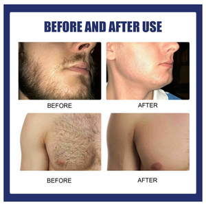 Crema depilatoria Eelhoe 60ml per <span class=keywords><strong>uomo</strong></span>, crema da barba per una rasatura levigante e ammorbidente, la migliore crema depilatoria per le zone intime - Product Image 3