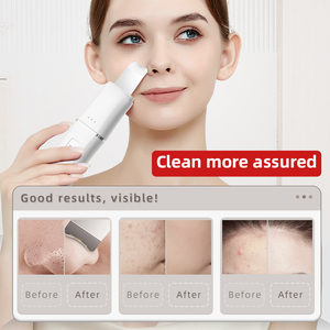 Ensemble d'appareils de soins de la peau de haute qualité <span class=keywords><strong>Beperfect</strong></span> Équipement de beauté multifonctionnel pour soins de la peau à domicile - Product Image 4