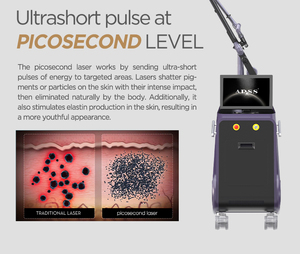 เครื่องเลเซอร์กำจัดรอยสักแบบเลเซอร์ Picosecond 1064nm 532nm เลเซอร์ <span class=keywords><strong>Pico</strong></span> แบบมืออาชีพ - Product Image 3