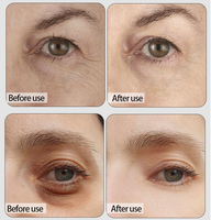 Masque oculaire au vinaigre de collagène naturel OEM, patch pour les yeux, anti-vieillissement, perle en or noir, hydrogel au collagène