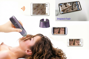 Analyseur de follicules et scanner de perte de cheveux HOT, mini appareil portable HD 2MP <span class=keywords><strong>sans</strong></span> <span class=keywords><strong>fil</strong></span> pour l'analyse du cuir chevelu - Product Image 6