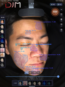 DJM 2025高端专业扫描面表机数字3D面部皮肤扫描仪面部分析机 - Product Image 4