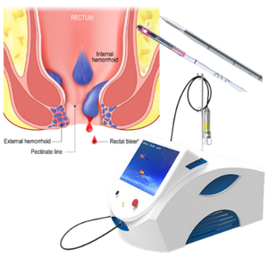 Láser de Diodo de 1470nm para <span class=keywords><strong>Tratamiento</strong></span> de <span class=keywords><strong>Hemorroides</strong></span>, Cortador Médico, Anestesista, Proctoscopio, Hernia, Aparato Quirúrgico - Product Image 1