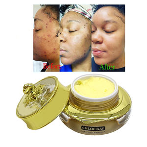 <span class=keywords><strong>Crema</strong></span> effetto forte sbiancante viso e corpo Anti-lentiggine vitamina c e collagene <span class=keywords><strong>crema</strong></span> da giorno idratante per sbiancamento della pelle <span class=keywords><strong>mezzo</strong></span> Cast - Product Image 4