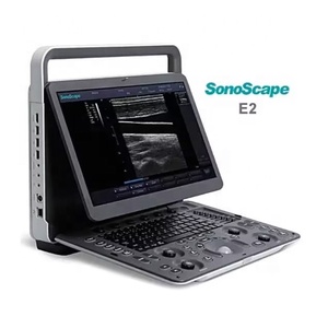 Ecógrafo Portátil Sonoscape E2V de Buena Calidad y Ecógrafo Doppler Color para Uso Veterinario con la Mejor Calidad y Precio Bajo - Product Image 1