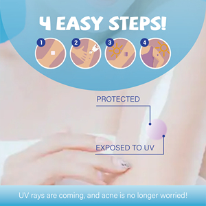 Dotdot de patch anti-acné UV de haute qualité en gros-20pcs nouveau design avec coeur de fleur - Product Image 3