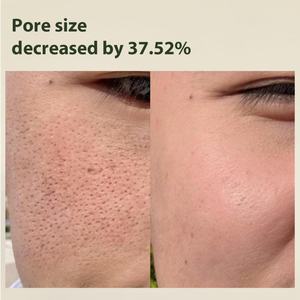 Crème Visage Hydratante Apaisante Instantanée Végane Coréenne Anti-Points Noirs à l'Acide Hyaluronique et Céramide pour une Barrière Cutanée Apaisante - Product Image 6