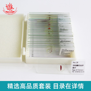 25 diapositivas de muestras microscópicas de parásitos, con fijación estándar para investigación de parasitología clásica. - Product Image 2