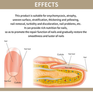 Crema Corporal Herbal Antifúngica para Uñas con Vitamina E de Marca Privada para el Cuidado de los Pies, Onicomicosis, Paroniquia, Hongos en las Uñas - Product Image 6