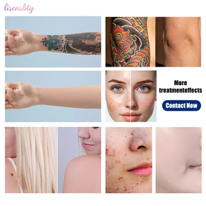 Machine à laser Pico haute efficacité 1064 nm 532 nm, séances de traitement courtes pour l'élimination des tatouages et la réduction des cicatrices - Product Image 6