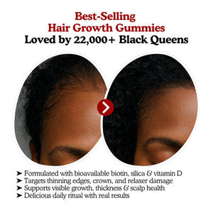 Permen Penumbuh Rambut Pasokan Langsung Pabrik untuk Suplemen Kecantikan Permen untuk Rambut Sehat Vitamin D Permen - Product Image 2