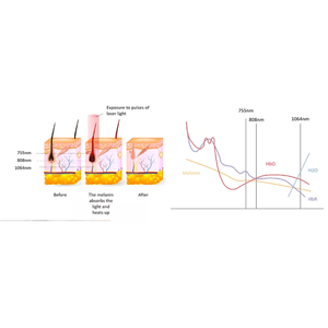 เครื่องกำจัดขนด้วยไดโอด, อุปกรณ์กำจัดขนทุกสีผิว, กำจัดขนแบบเต็มย่านความถี่, อุปกรณ์กำจัดขนเพื่อฟื้นฟูผิว - Product Image 4