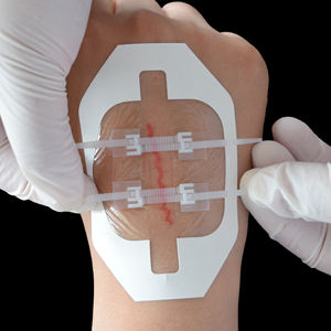 Bandes adhésives Steri-Strips pour la fermeture des plaies, bandages élastiques souples, respirants, avec fermeture éclair, hypoallergéniques, film polyuréthane adhésif - Product Image 5