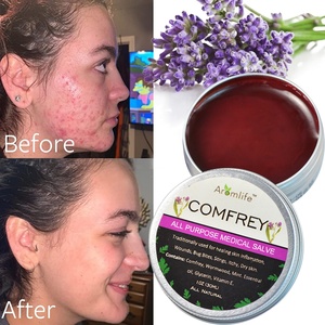 Ungüento de Consuelda Totalmente Natural y Ecológico para Dolores Musculares, Erupciones, Moretones, Artritis, Picaduras de Mosquitos y Comezón - Product Image 1