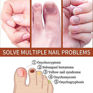 IBeaLee Natural Foot Hand Toe Nail Fungus Anti Treatment Liquid Serum Essence Product - Product Image 2