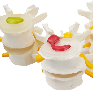 Tussenwervelschijf Degeneratie Osteoporose Model Lumbale Hernia Model Normale Plastic Lumbale Wervelkolom Model - Product Image 6