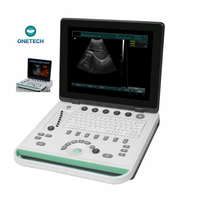 Instruments à ultrasons médicaux pour la grossesse machine à ultrasons bon marché 2d 3d mini machine à ultrasons portable