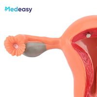 Modelo de Útero Femenino Desmontable Medeasy, Modelo de Vagina, Modelo Anatómico de Útero y Ovario Humano, Modelos de Ciencias Médicas