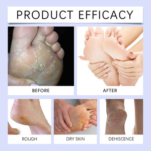 Crème réparatrice pour les pieds anti-fongique pour l'élimination des peaux mortes Peeling Hydratant Exfoliation Soin des pieds Crème réparatrice pour talons crevassés - Product Image 6