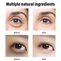 Crème pour les yeux au rétinol AHA 30% BHA 2% Prête à être expédiée Vente en gros Hydratant lissant pour les soins de la peau Vente en gros au détail