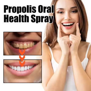 <span class=keywords><strong>Propolis</strong></span> antibactérien Oral <span class=keywords><strong>Spray</strong></span> bouche nettoyant respirant désodorisant pour ulcères pharyngite gouttes orales stérilisation 20ML - Product Image 2