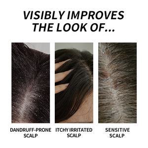 Shampoo antipelliculaire apaisant pour les démangeaisons, marque privée, nettoyage des cheveux, perle, rafraîchissement du <span class=keywords><strong>cuir</strong></span> <span class=keywords><strong>chevelu</strong></span>, apaisant, hydratant, pour cheveux sensibles - Product Image 6