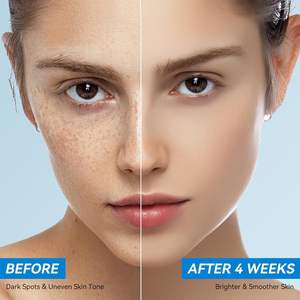 <span class=keywords><strong>Crema</strong></span> Correttiva per Macchie Scure su <span class=keywords><strong>Viso</strong></span> e Corpo, per Macchie dell'Età, Macchie Solari, Melasma, Lentiggini, Corregge Rapidamente il Tono della Pelle Non Uniforme - Product Image 5