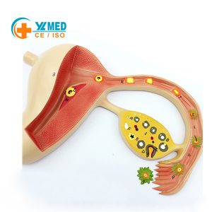 Modelo de Enseñanza del Proceso de Desarrollo del Útero y los Óvulos Humanos, Modelo de Órganos Reproductores Femeninos, Modelo Uteroinfalónico - Product Image 1