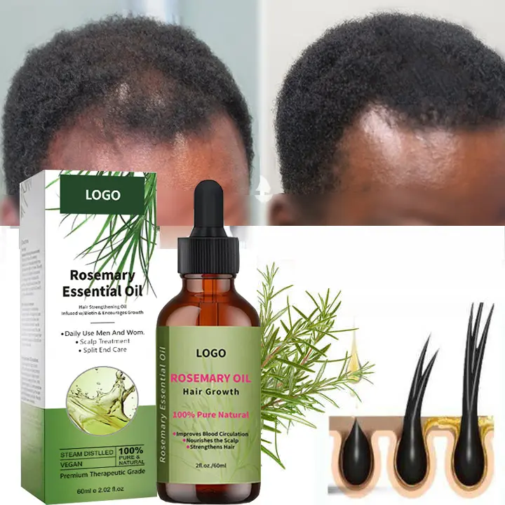 Private Label schwarze Frauen Haarpflege Behandlung Stärkung Rosmarin ätherisches Öl Bio Rosmarin öl Haarwuchs