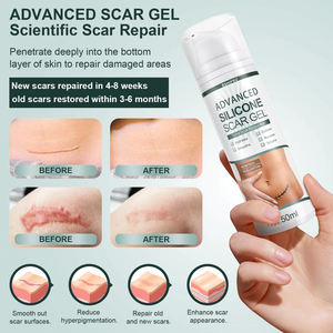 OEM ODM Intensive Narben reparatur creme und Gel Schnell wirkende effektive Körper narben behandlung mit Kollagen reduziert Markierungen - Product Image 4