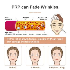 Tube PRP avec kit complet de solutions pour la correction des poils du visage - Product Image 4